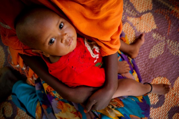 UNICEF: 7,5 mln dzieci na świecie umiera z głodu Dziecko, LIFESTYLE - Najgorsza sytuacja jest w Jemenie, Nigerii, Sudanie Południowym i Somalii. W krajach tych odnotowano 4. stopień w 5-stopniowej skali zagrożenia bezpieczeństwa żywnościowego. Ostatni stopień oznacza klęskę głodu.